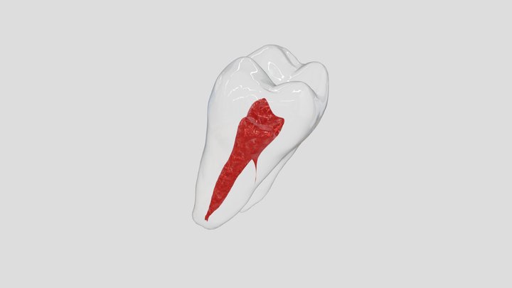37 Endo 3D Model