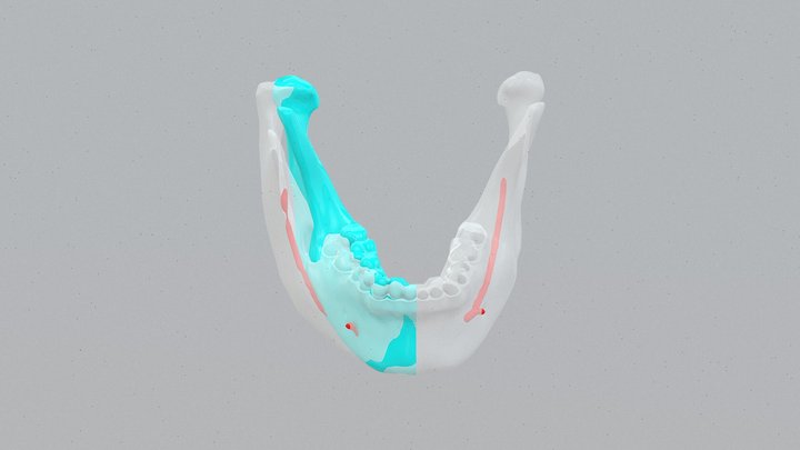 20260213-01 3D Model
