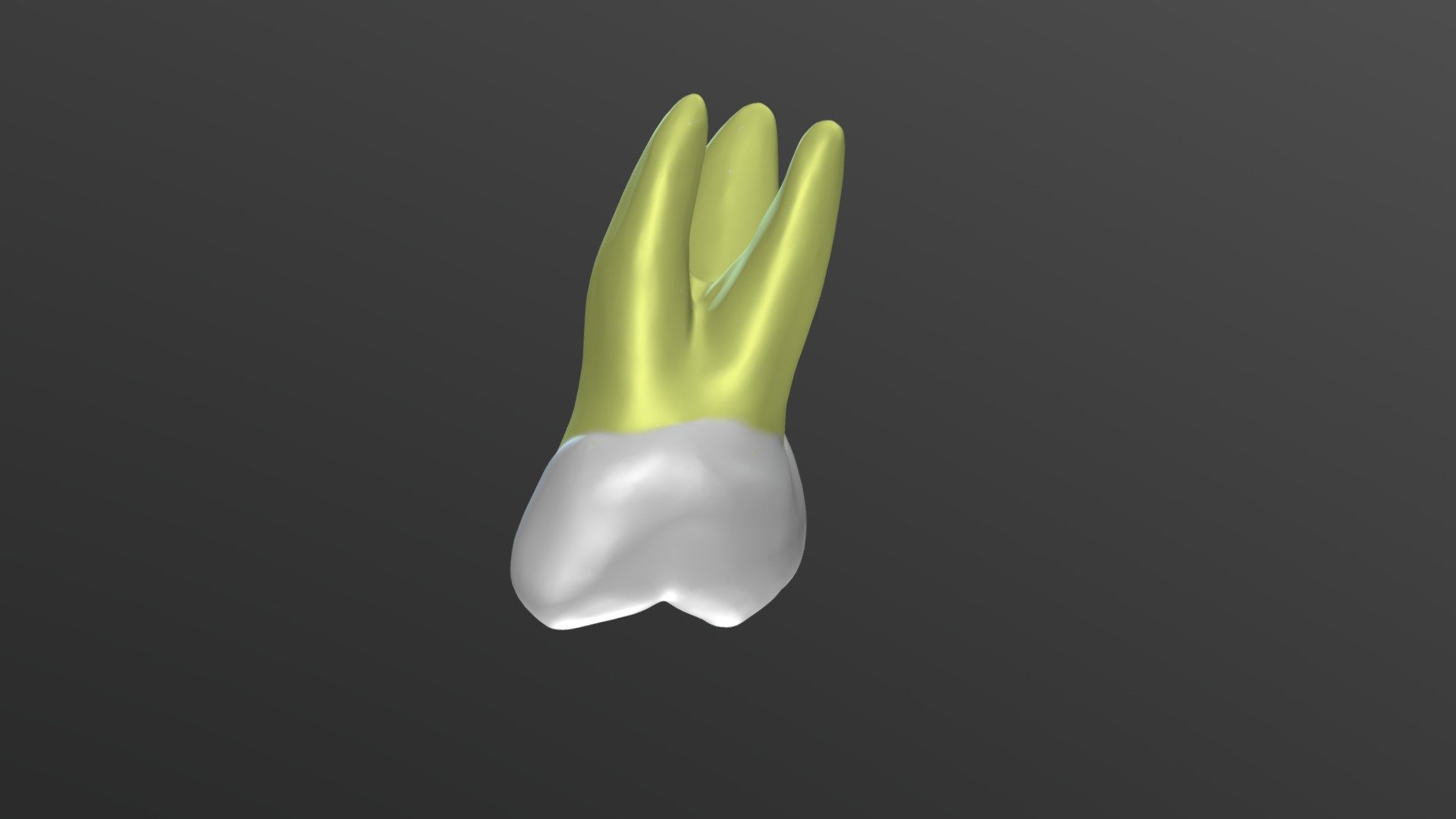 Maxillary Permanent Left Second Molar