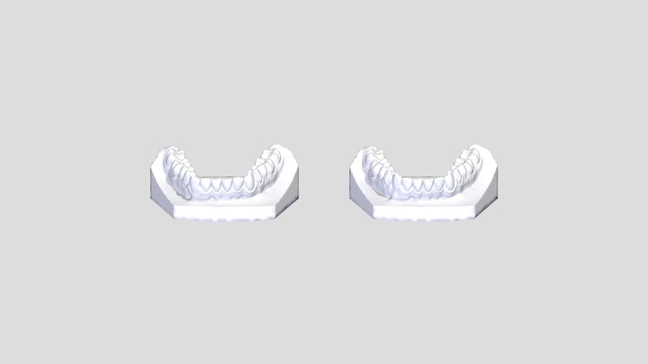 許X茿-下顎 3D Model