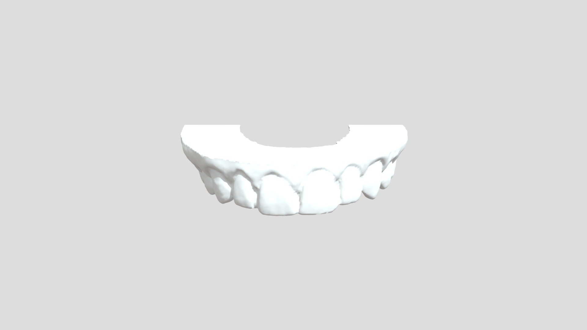 3d dental Model for Upper Teeth -SportingSmiles - 3D model by ...