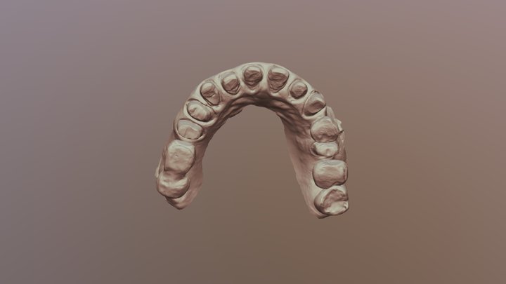 Upper Jaw Scan 3D Model