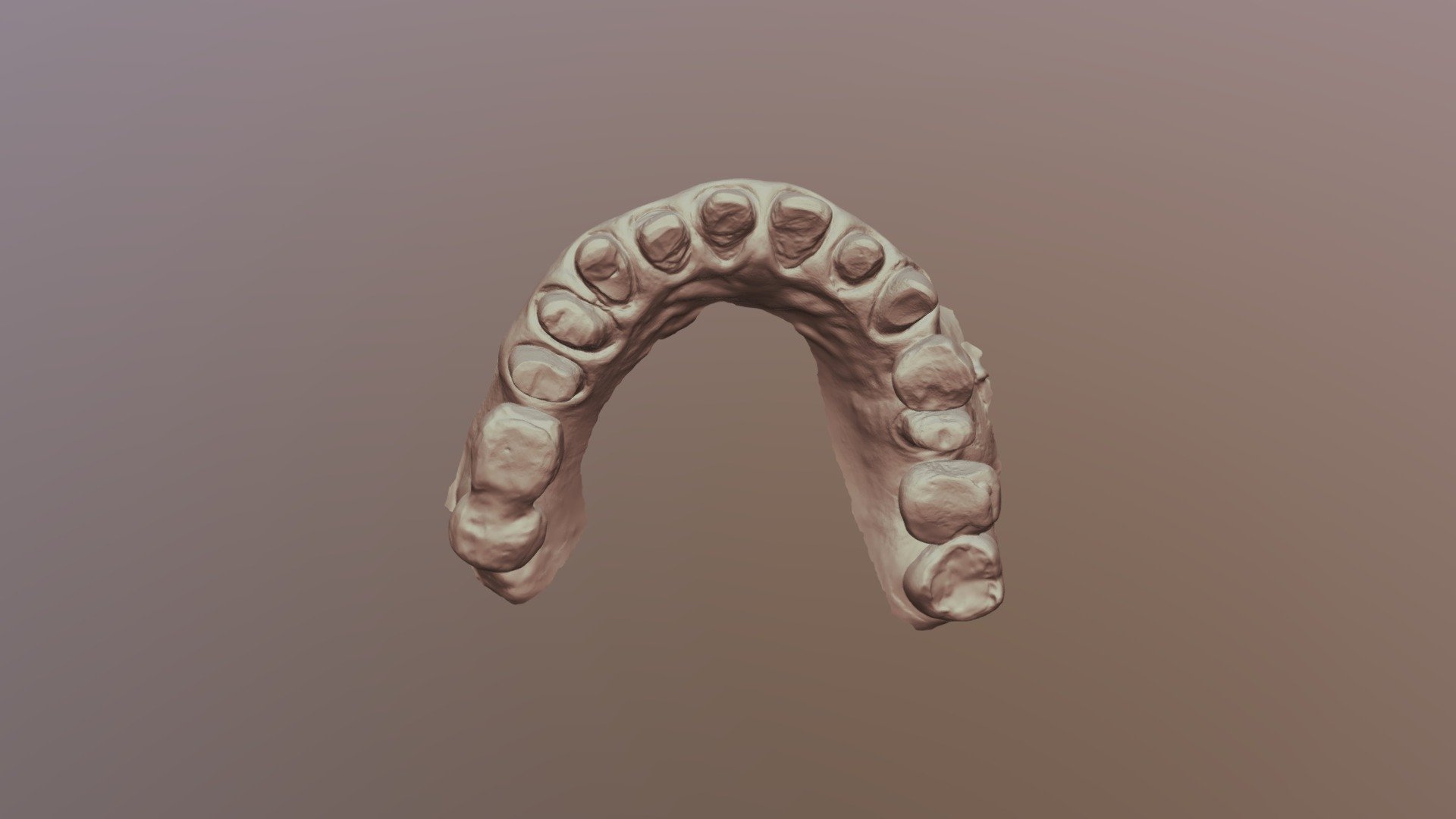 Upper Jaw Scan - 3D model by wawayu99 [8c4a0f9] - Sketchfab