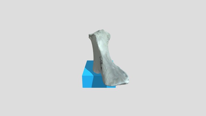 Pubic Symphysis VI-1 3D Model