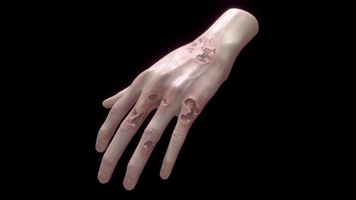 Wounded hand 3D Model