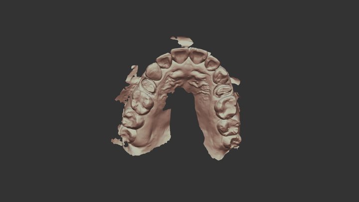 15,25 emax crown Upper Jaw Scan 3D Model