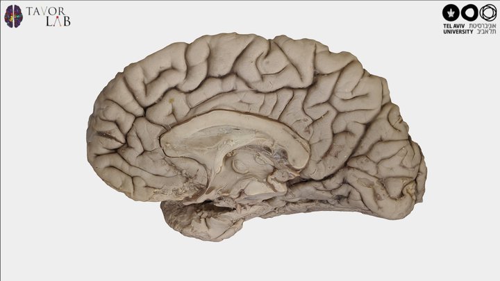 The medial surface of the hemisphere 3D Model