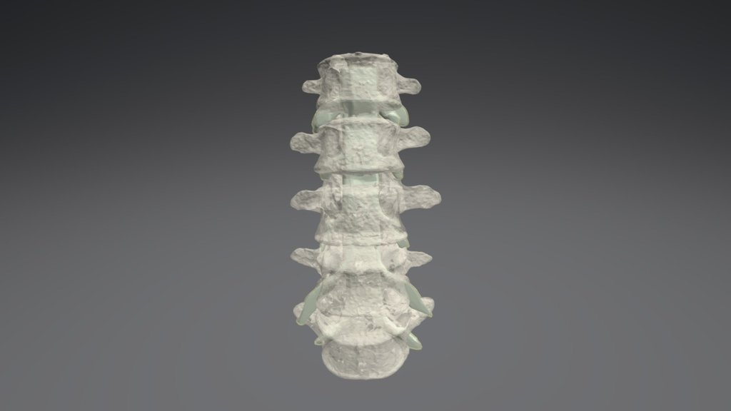 L1-5 Transparent