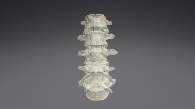 L1-5 Transparent 3D Model