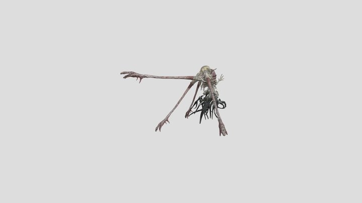 patient number 2 3D Model