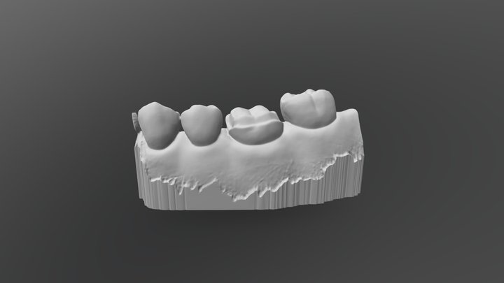 Crownlay 3D Model