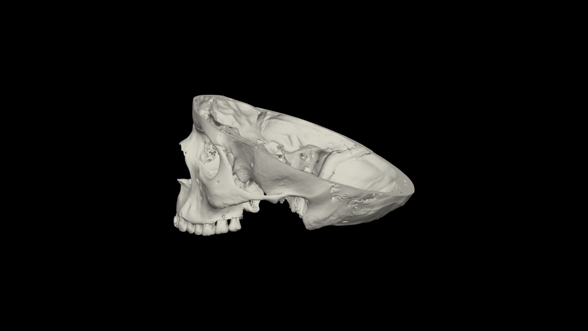 H. sapiens cranium | Transverse cut - 3D model by hugodutel [8d9fdeb ...