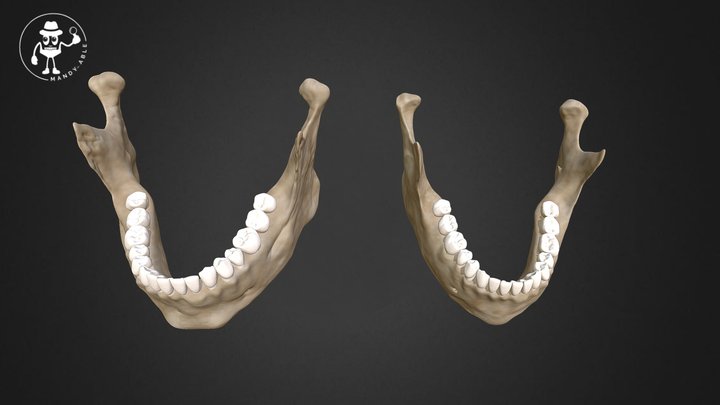 Male vs Female Mandible 3D Model