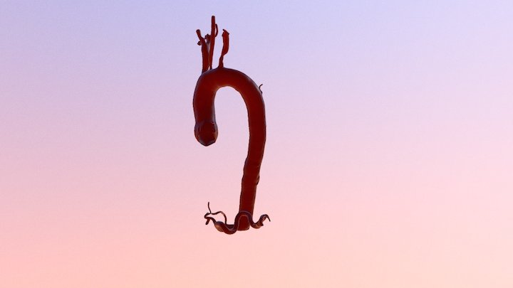 Aorta 3D Model
