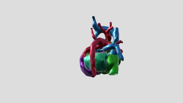 ANOMALOUS_DRAIN_HEART_HUVH 3D Model