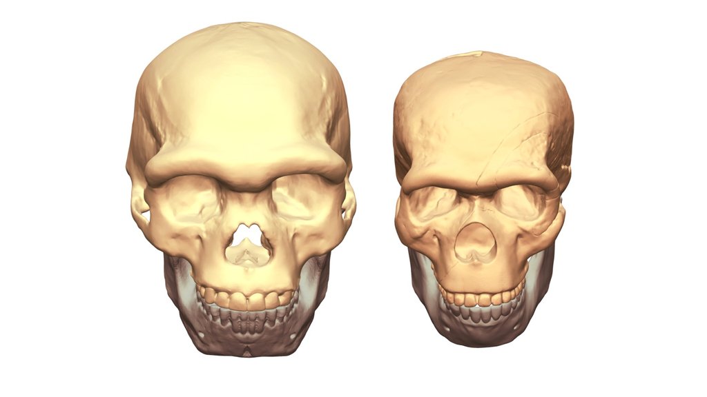 Is The Steinheim Female a Longi/Denisovan?