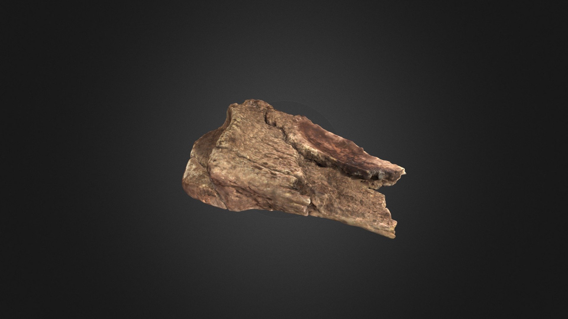 Posible Distal Ulna