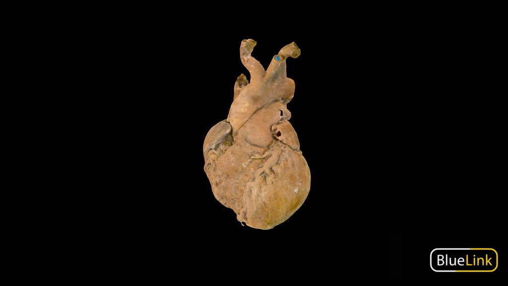 Plastinated Organs A 3D model collection by Bluelink Anatomy