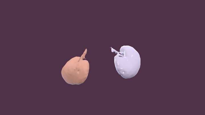 Kidney Segmentations 3D Model