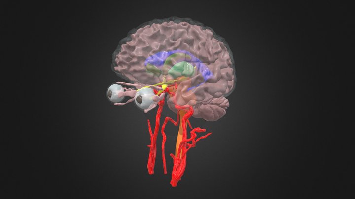 MRI Brain 3D Model