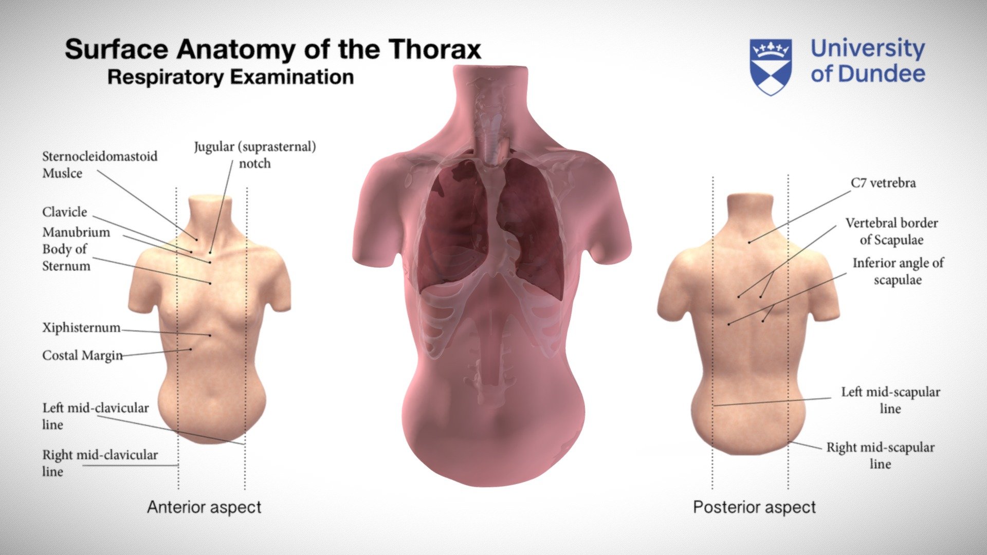 Surface anatomy of the thorax - female torso