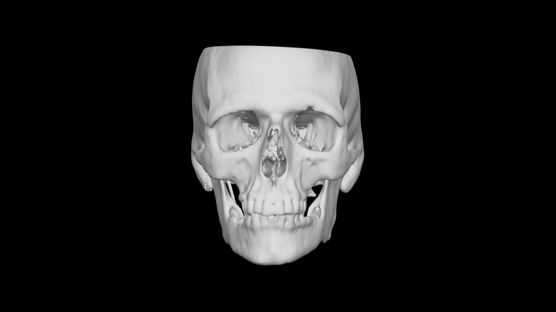 Skull Male 40yo