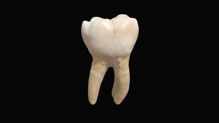 Primer molar mandibular derecho (4.6) 3D Model