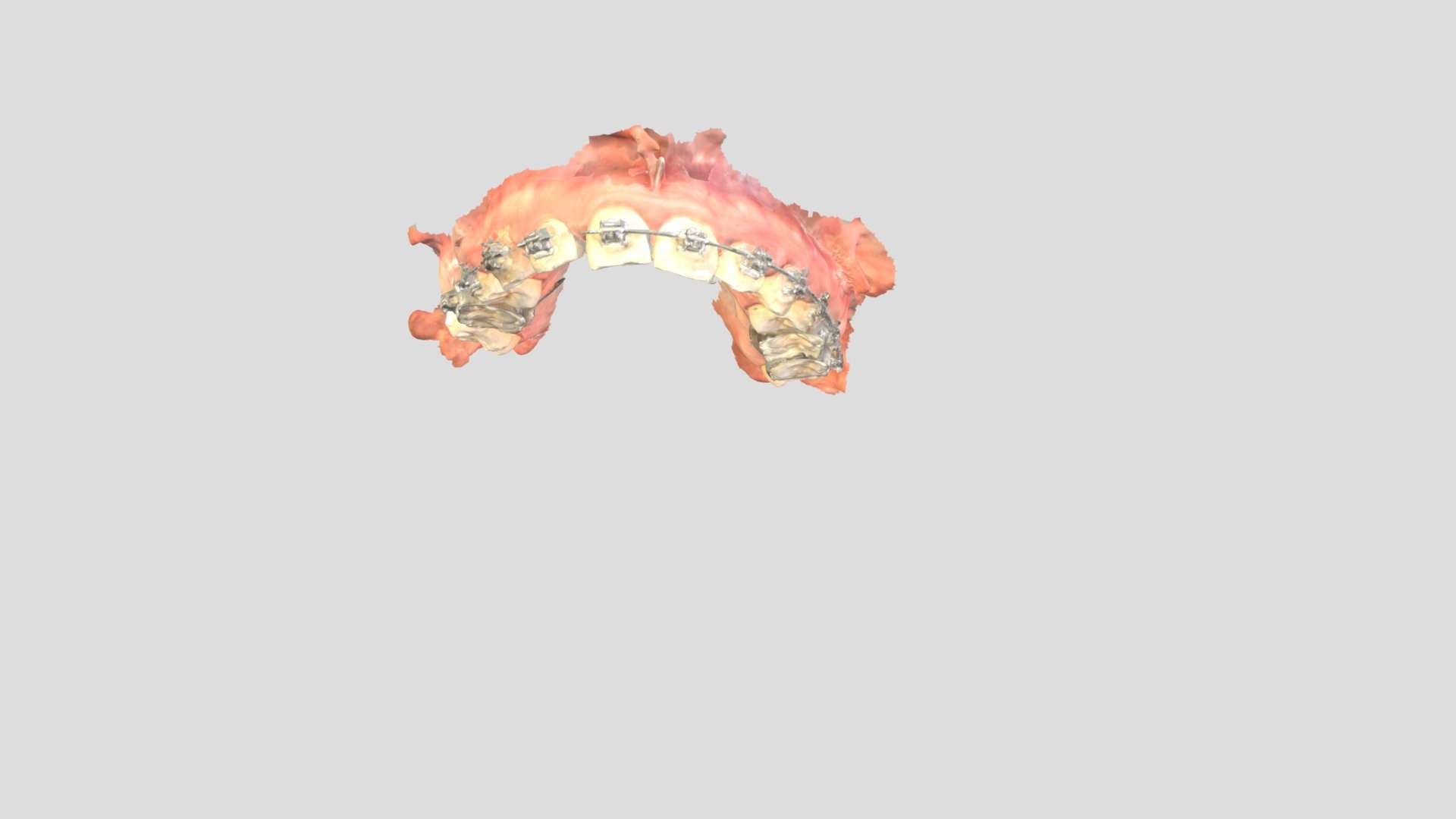 8074730-maxillary