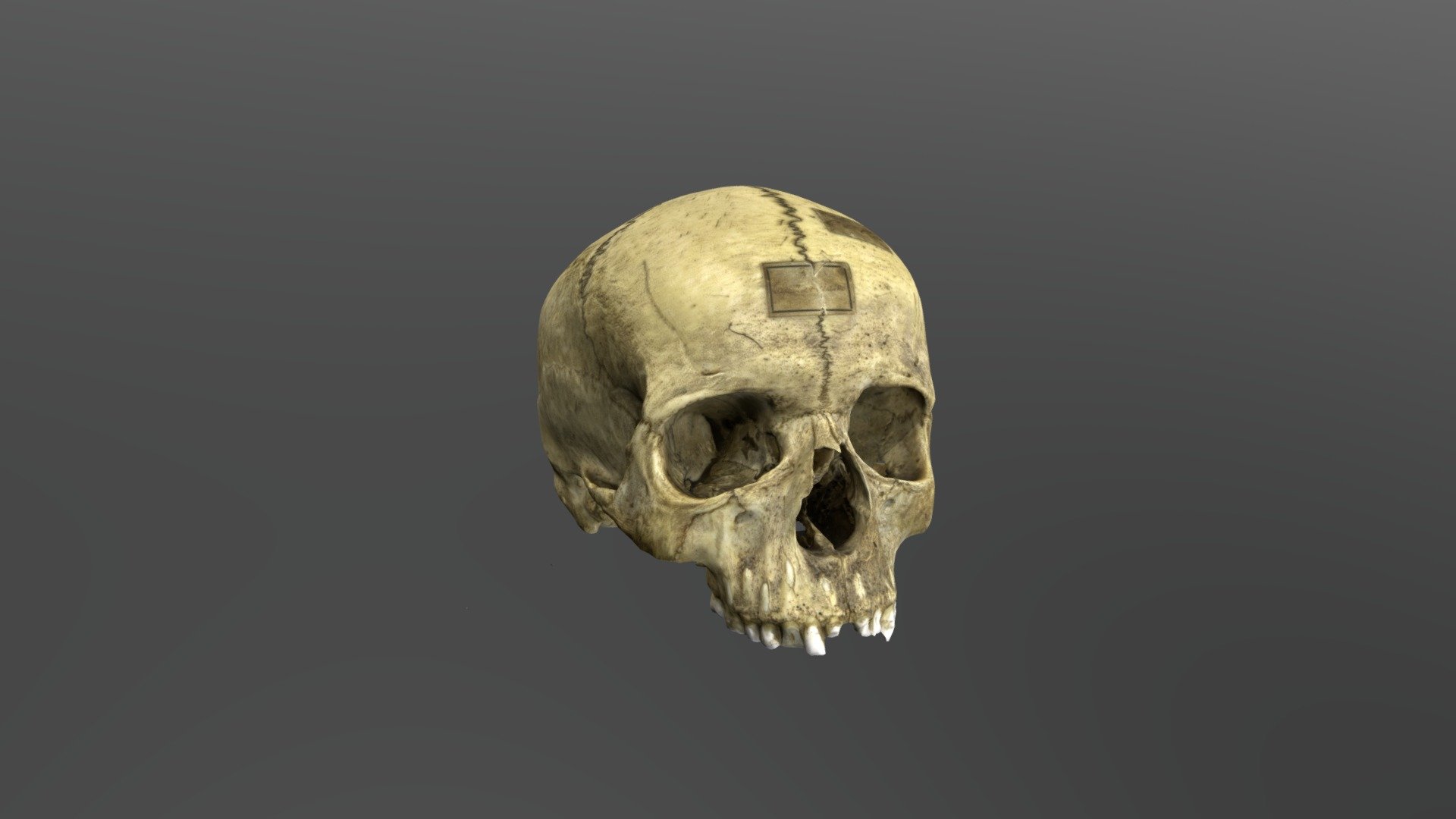 Human Skull