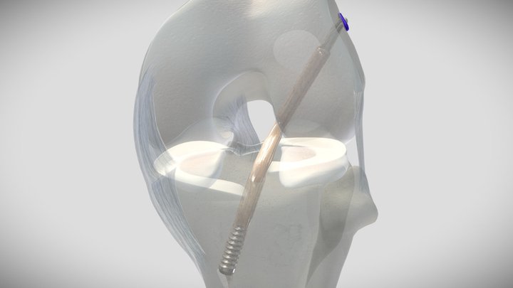 SECURE-LOOP 3D Model