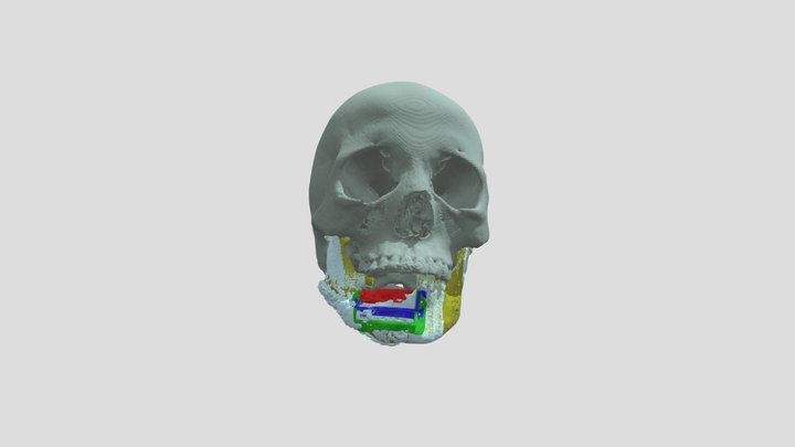 case id:85787 3D Model