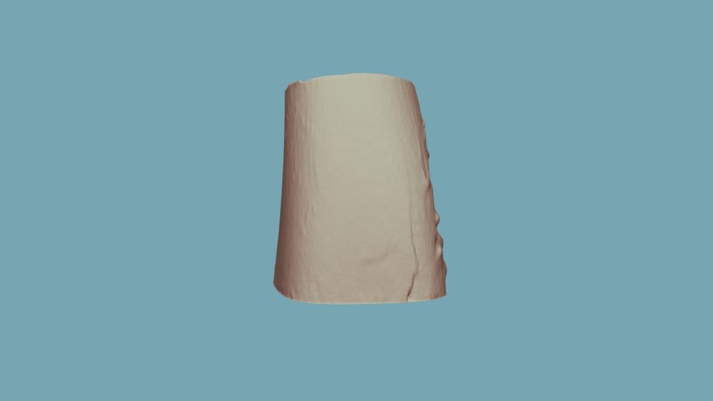 4-2 (Post-burn)