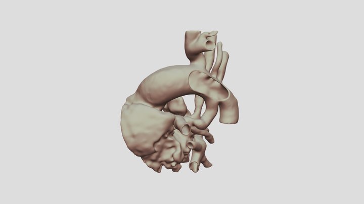 Pulmonary Atresia 3D Model