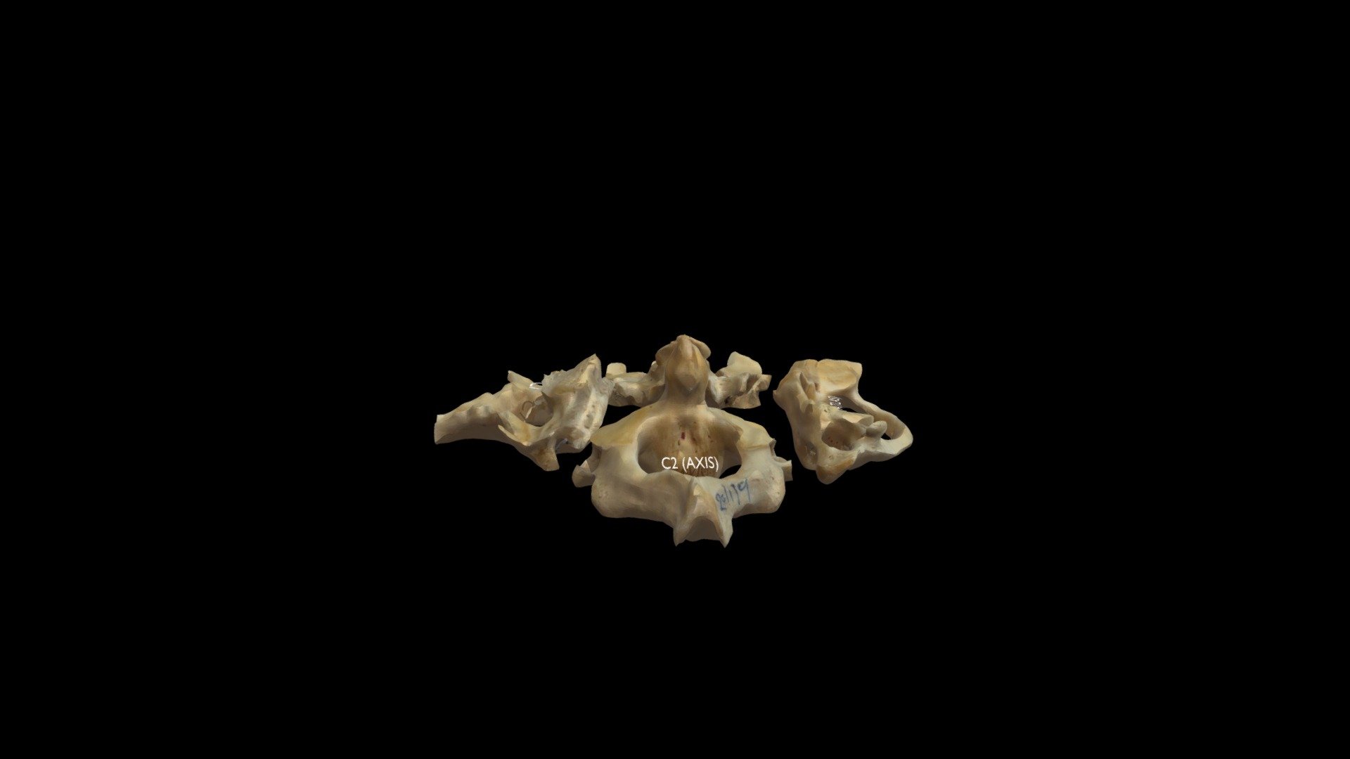 Superior View Of Cervical Vertebra