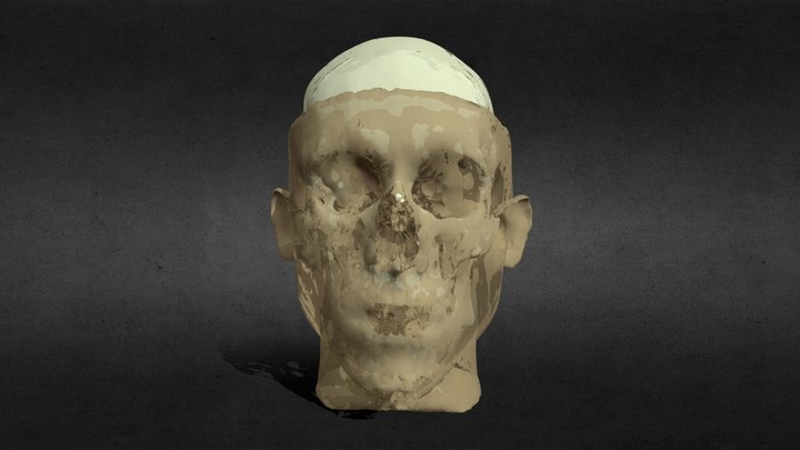 Bicycle Accident Head 3D Model