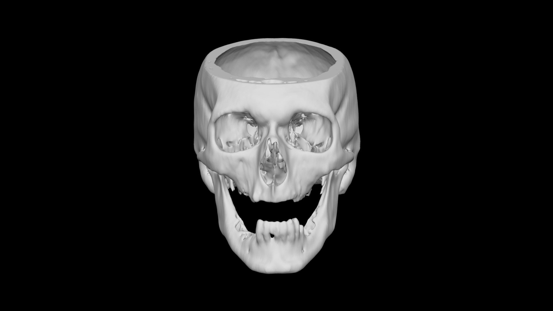 Skull Male 67yo