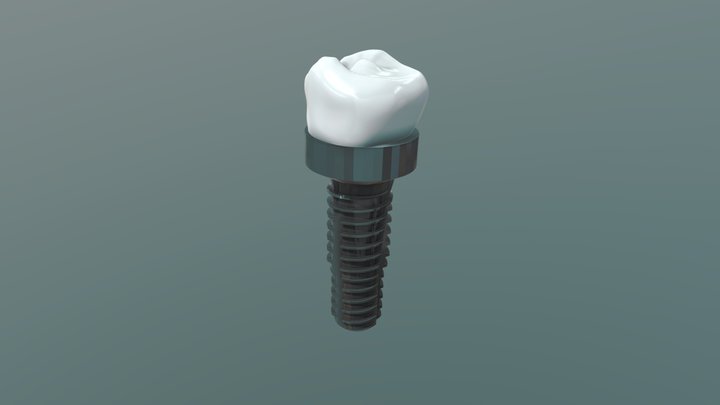 Implant Sculpting Software. Item #6683 3D Model