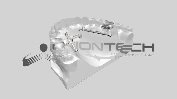 UNIONTECH_Distalizzatore 3D Model