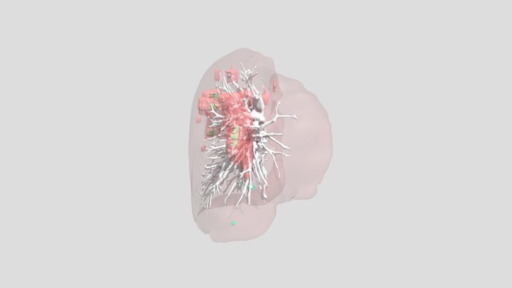 Case496_ai_set1 3D Model