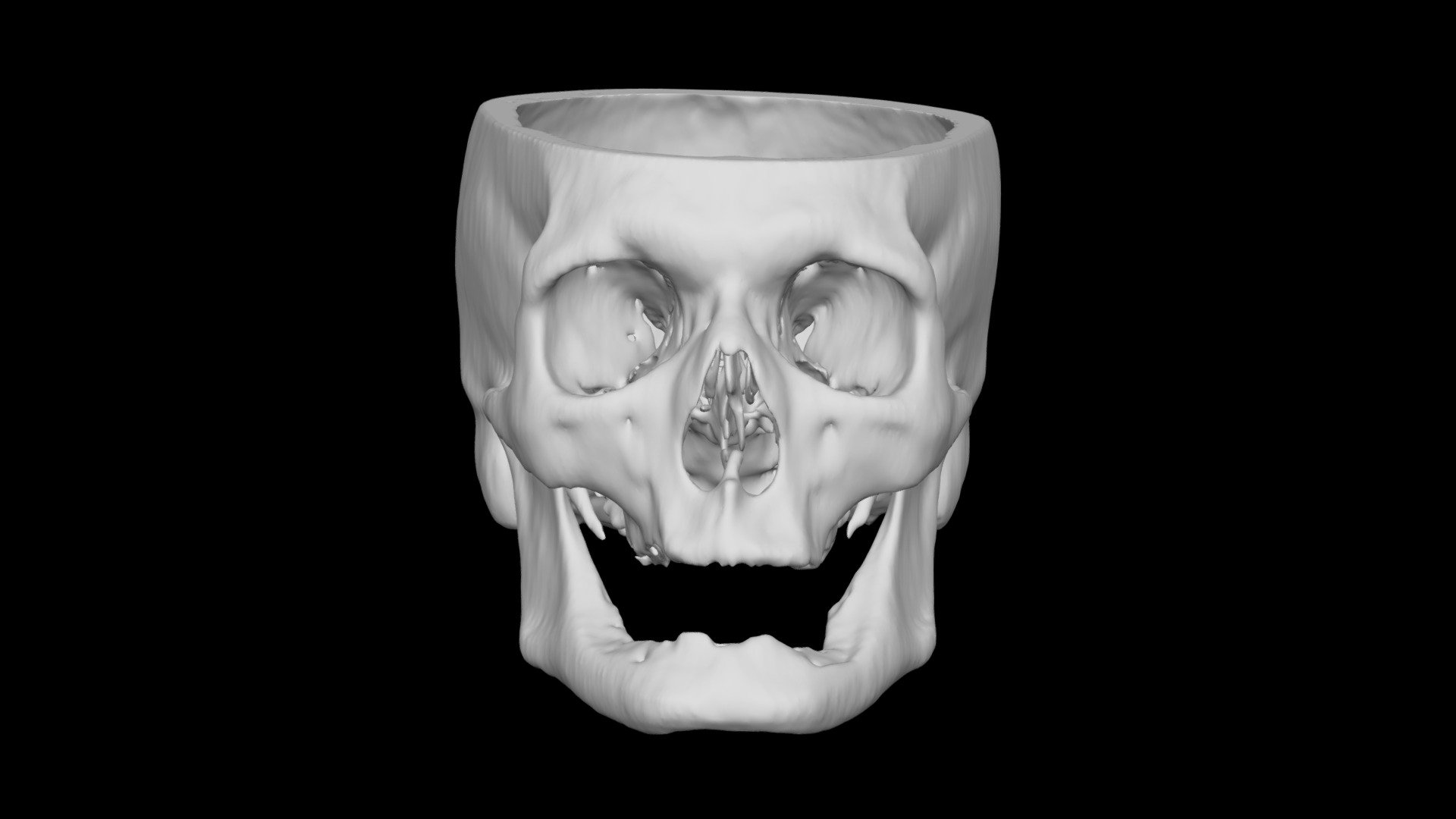 Skull Male 69yo