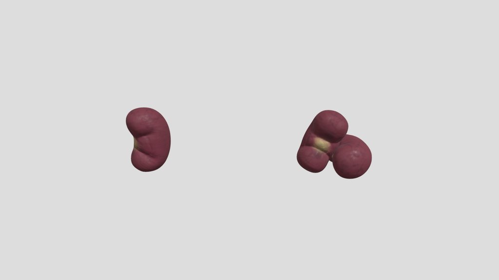 Exposed Kidneys