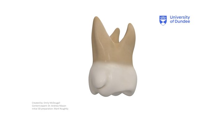 Maxillary First Molar with Cusp of Carabelli – Modello 3D gratuito STL