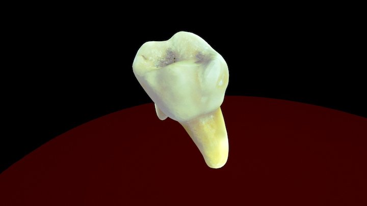 Tooth (Molar) 3D Model