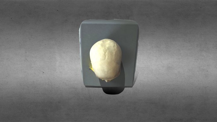 Low-quality medical skull 3D Model