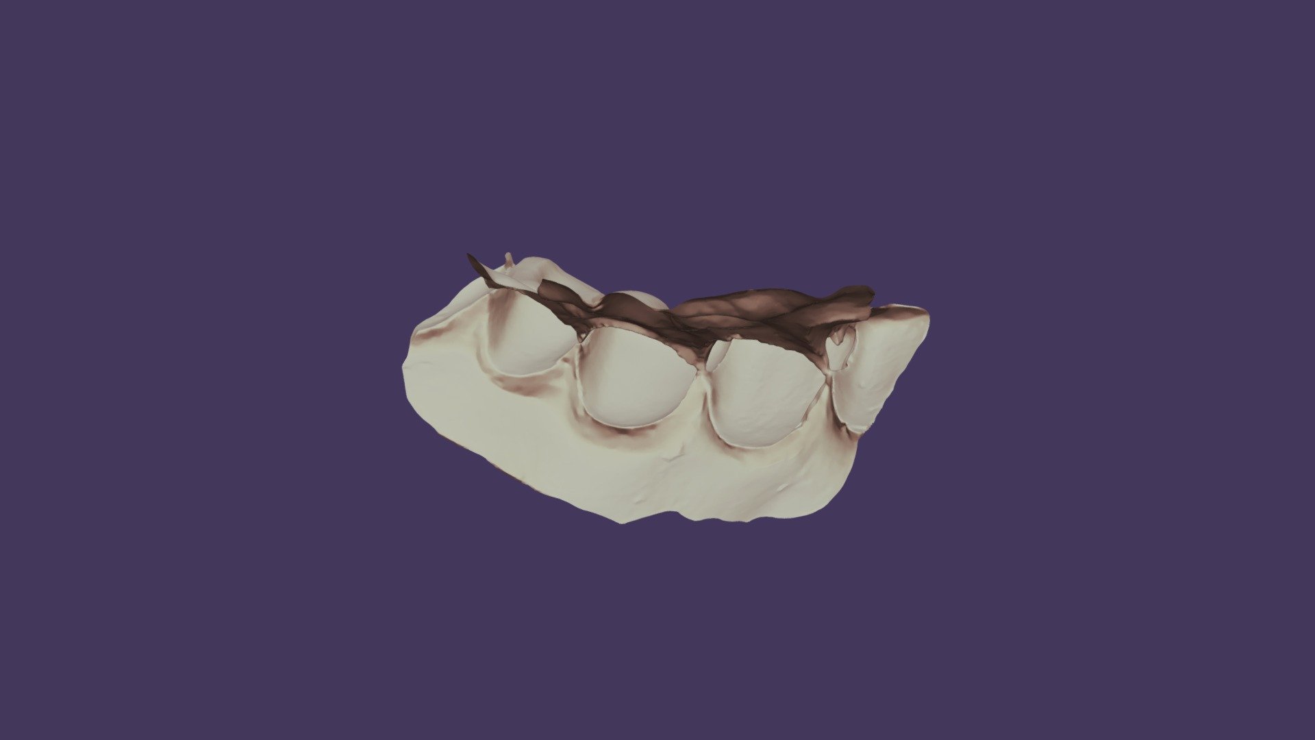 Group 16 #8 Waxup Upper Jaw