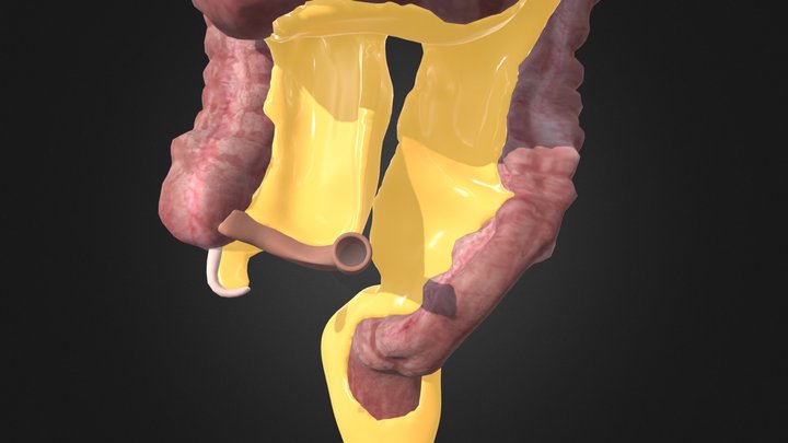 QR 7 – colon and mesocolon 3D Model