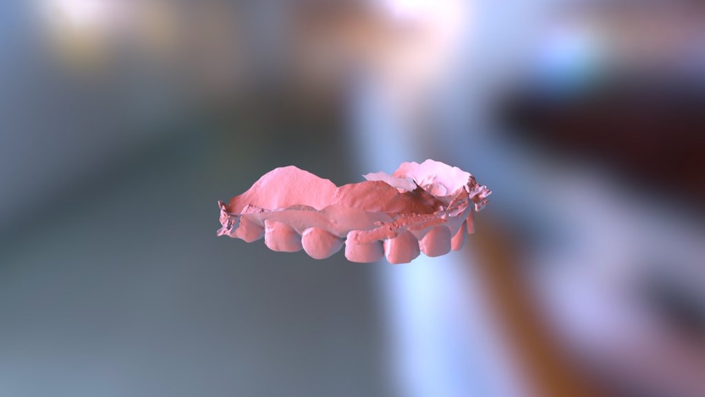 Michael Upper Jaw