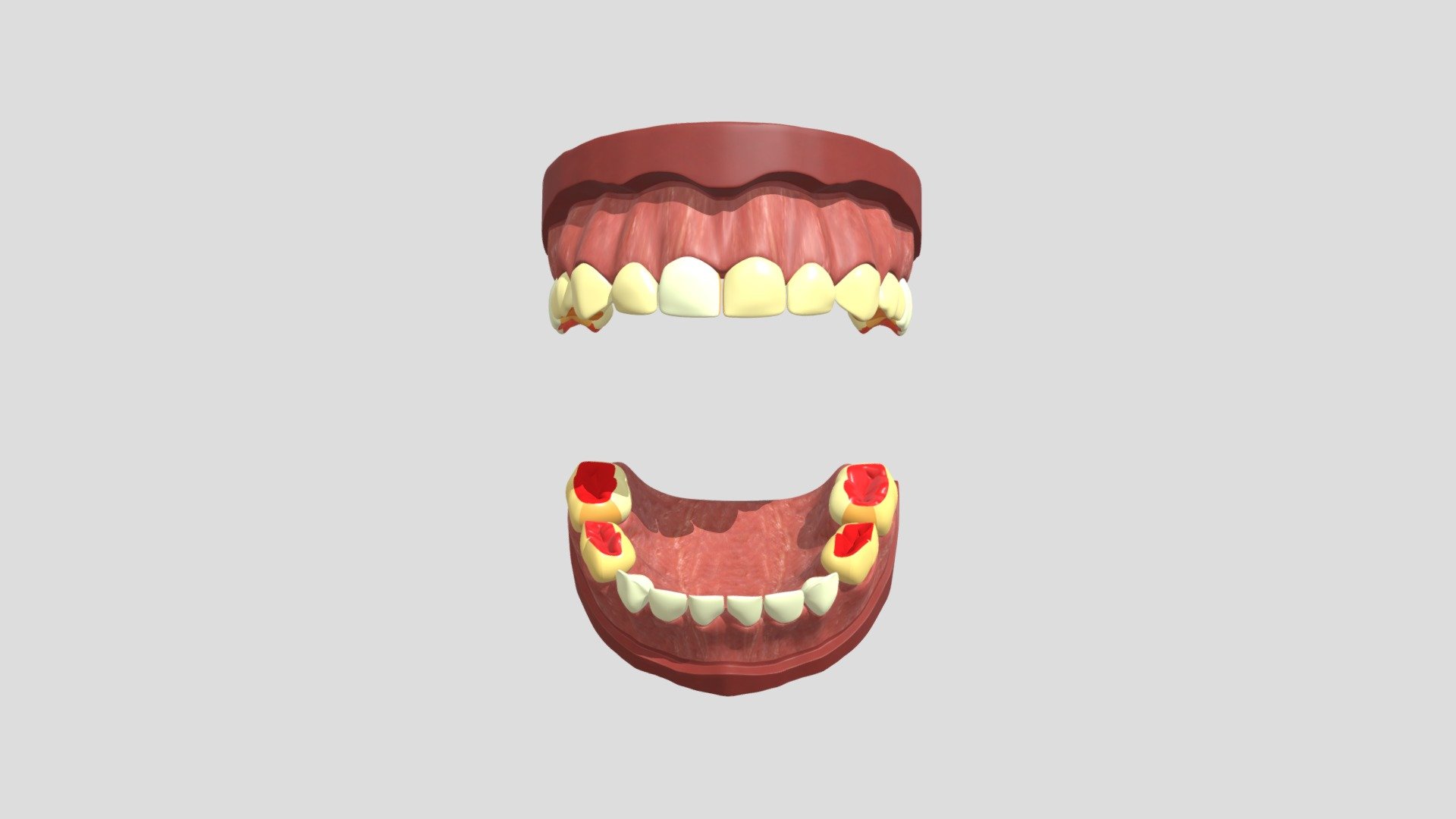 LC6_Model2