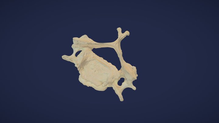 6. Halswirbel (C6) - 6th cervical vertebra 3D Model