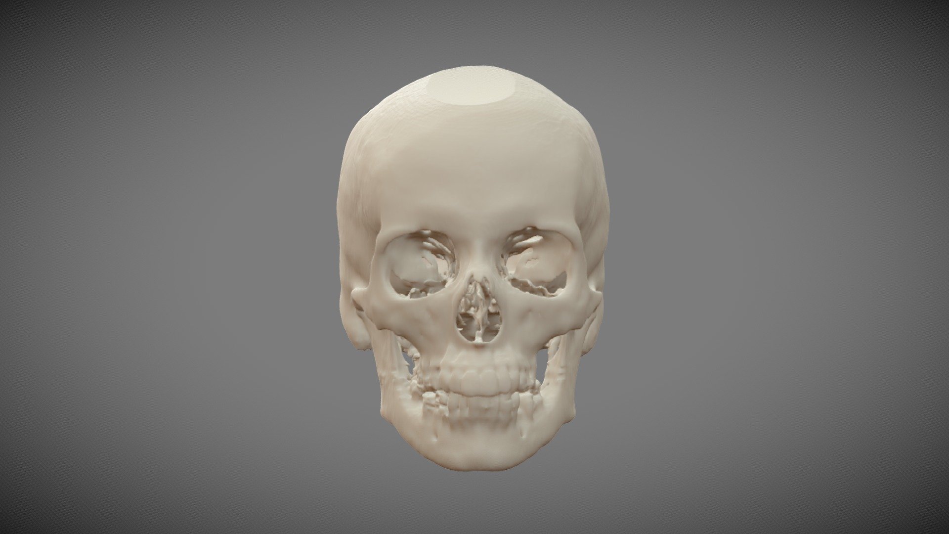 Skull Female 55yo